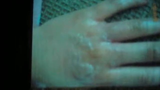 Ожог смотреть онлайн