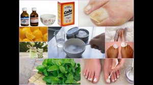 Грибок ногтей (Онихомикоз). Как лечить грибок ногтей в домашних условиях. Средства от грибка ногтей