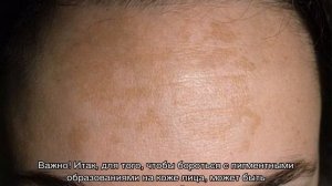Пигментные пятна на лице: причины и лечение