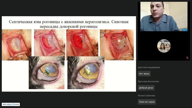 Септические язвы роговицы Подходы к лечению смотреть онлайн