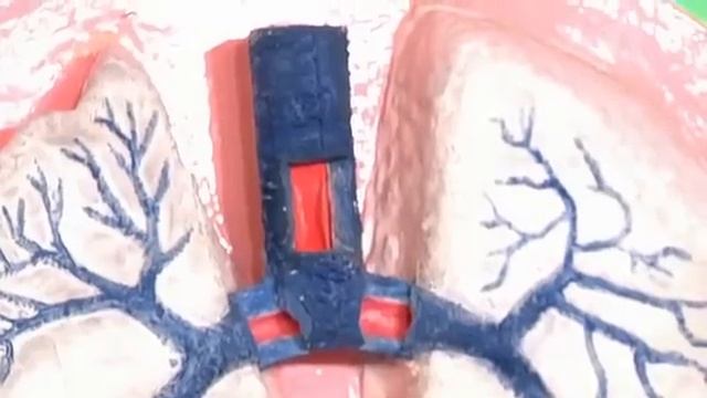 Ларингит -- ложный круп смотреть онлайн