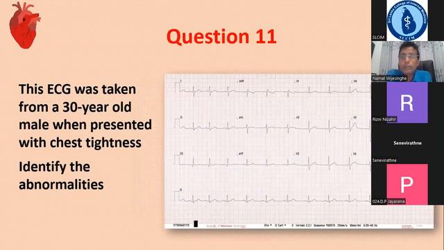 Senior Registrars' Forum - ECG Beyond Basics by Prof Namal Wijesinghe смотреть онлайн