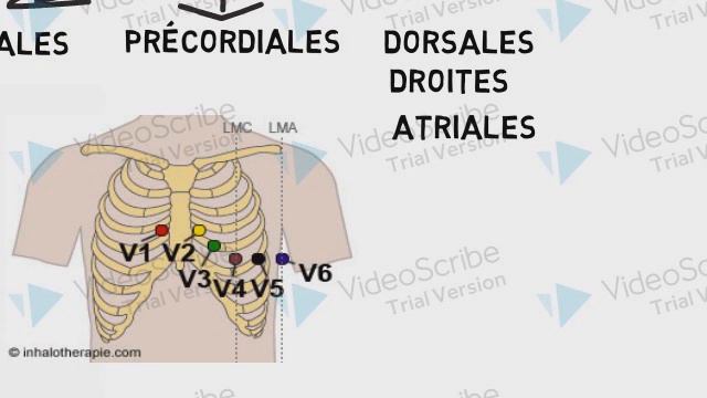 Bases d'interprétation d'un ECG normal смотреть онлайн