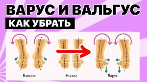 Тренировка от плоскостопия и вальгуса. Улучшение пронации и супинации. МФР и Мобилизация стопы