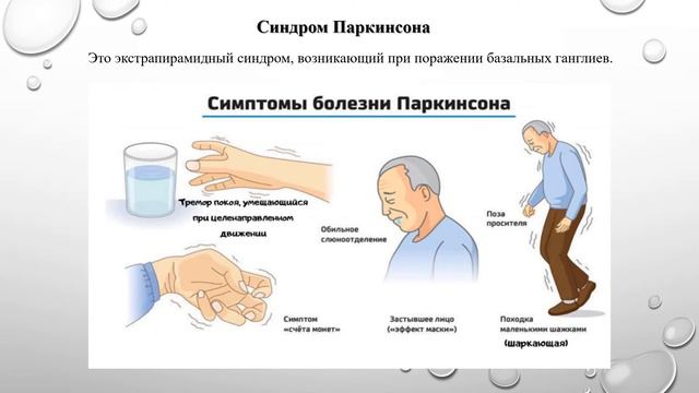 НЕВРОЛОГИЧЕСКИЕ СИНДРОМЫ смотреть онлайн