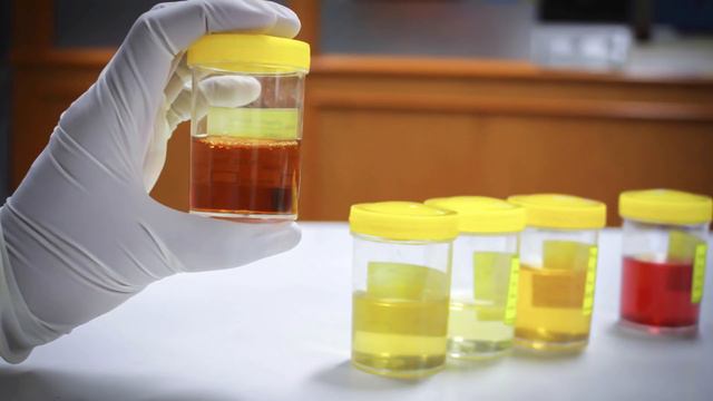 Что происходит с организмом, если он испытывает НЕДОСТАТОК ВОДЫ? смотреть онлайн