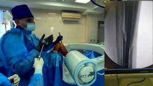 БИОС БОЛЬШЕБЕРЦОВОЙ КОСТИ. ВПРАВЛЕНИЕ ПРОВОДНИКОМ. БЛОКИРОВАНИЕ СВОБОДНОЙ РУКОЙ ( FREE HAND LOCKING