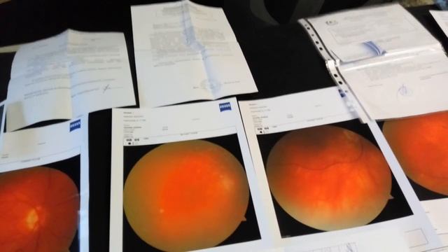 Отслоение сетчатки глаза. Исцели себя сам. Мои снимки и документы. смотреть онлайн