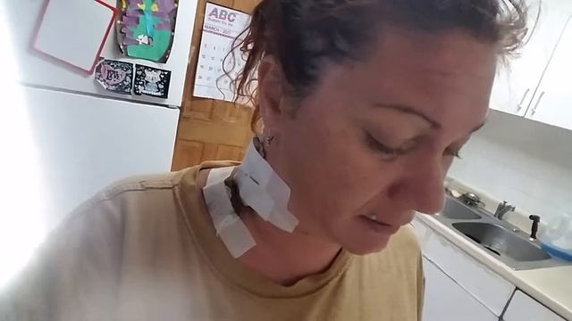 Lymphadenopathy/Lymphadenitis relief 3 смотреть онлайн