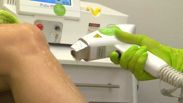 Лазерная эпиляция в клинике LASER ESTHETIC HALL смотреть онлайн