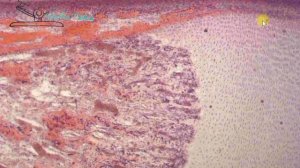 НЕПРЯМОЙ ОСТЕОГЕНЕЗ