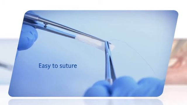 Geistlich Mucograft® пример использования! АПЕКС. смотреть онлайн