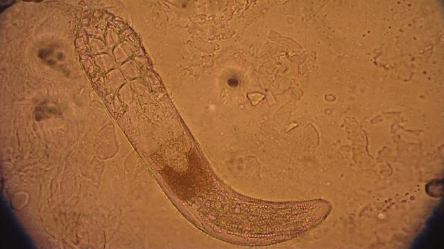 Demodex folliculorum mite under a microscope walking смотреть онлайн