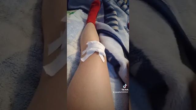 Рана до мяса не буду показывать что под этим меня забанят смотреть онлайн