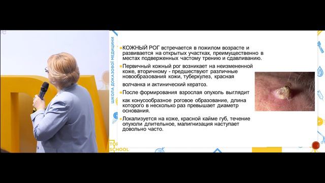 Шкірний ріг як одна з форм актинічного дерматозу смотреть онлайн