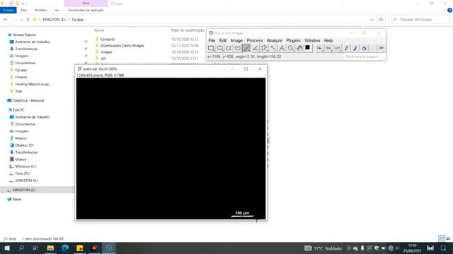 Unlock the Secrets of Wound Healing: Learn How to Analyze Scratch Assays with ImageJ смотреть онлайн