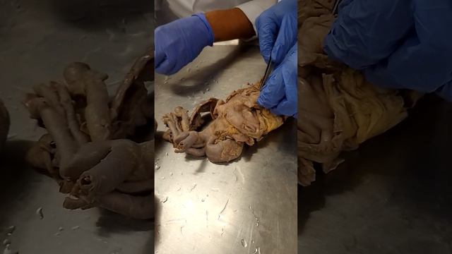 Cardiaco 10 смотреть онлайн