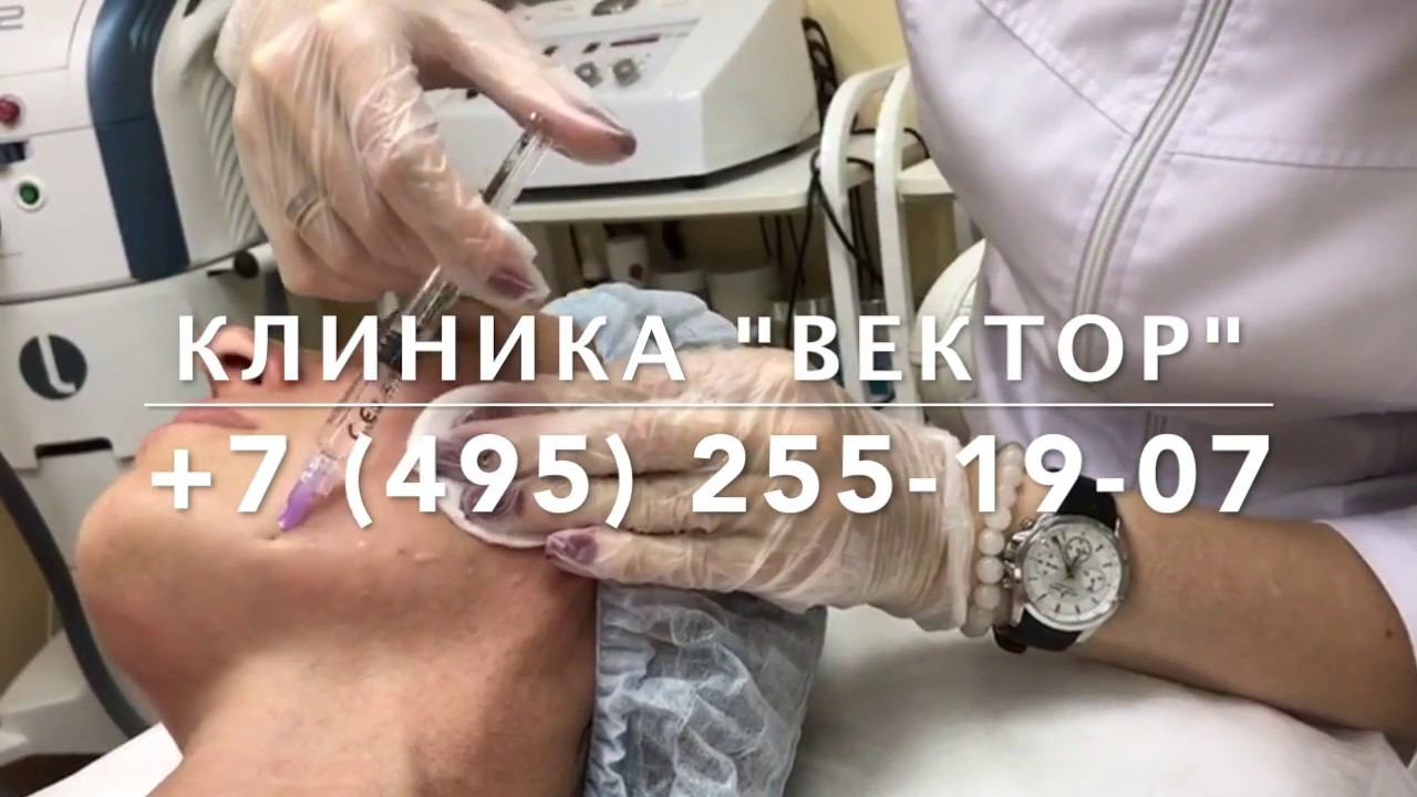 Биоревитализация препаратом "AQUASHINE HA" смотреть онлайн