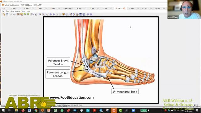 ABR Webinar n.15 - Splints & Orthoses. With Leonid Blyum смотреть онлайн