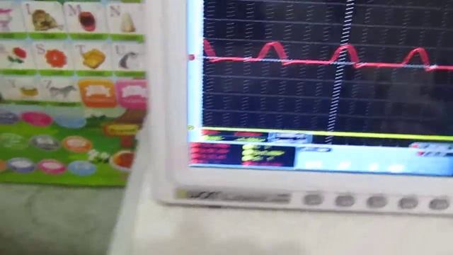 Резонанс в резонансе - ответка среды в резонансных системах смотреть онлайн