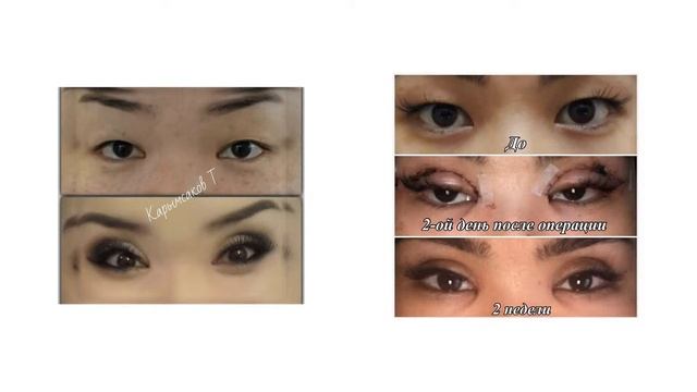 Пластическая хирургия в Алматы смотреть онлайн