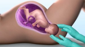 Доношенная Беременность. Оптимальный Срок Родов.