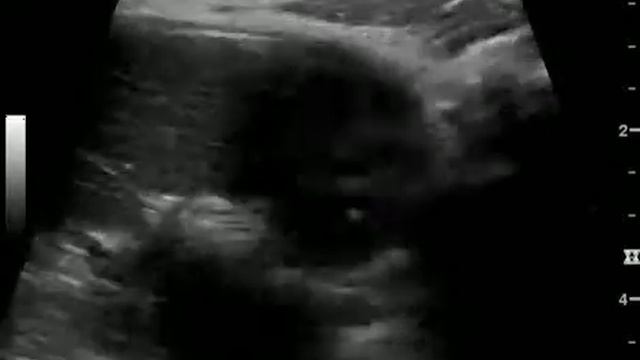 unnamed 1 13 смотреть онлайн
