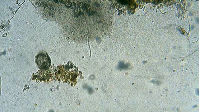 разнообразие инфузорий смотреть онлайн