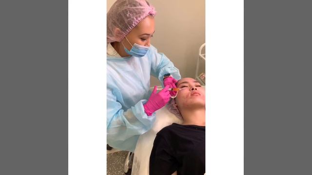 Лечение тяжёлой формы акне смотреть онлайн