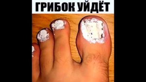 ГРИБОК Отсохнет с Корнем. Как быстро и эффективно вылечить грибок на ногах и руках.