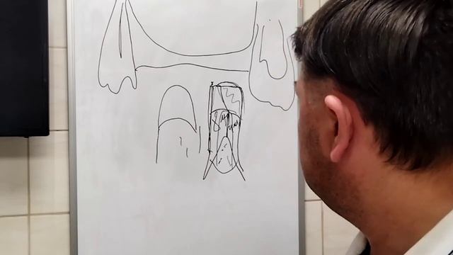 Можно ли ортопантомограмму использовать для планирования синуслифтинга. смотреть онлайн