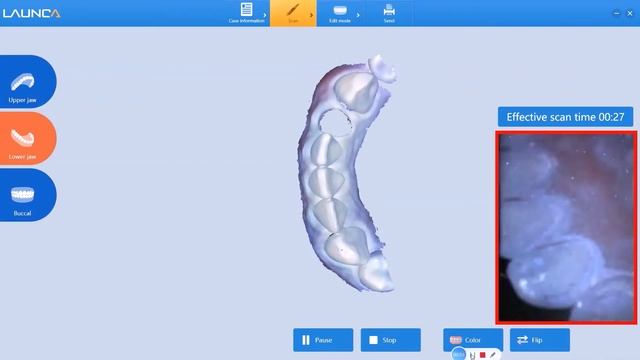 How to Resume scan method for Launca Intraoral scanner смотреть онлайн