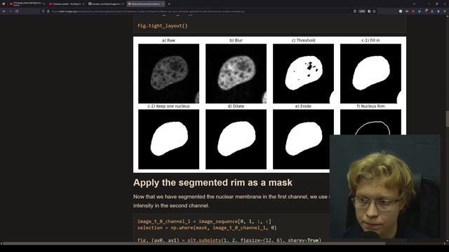 Working with DICOM files in Python смотреть онлайн