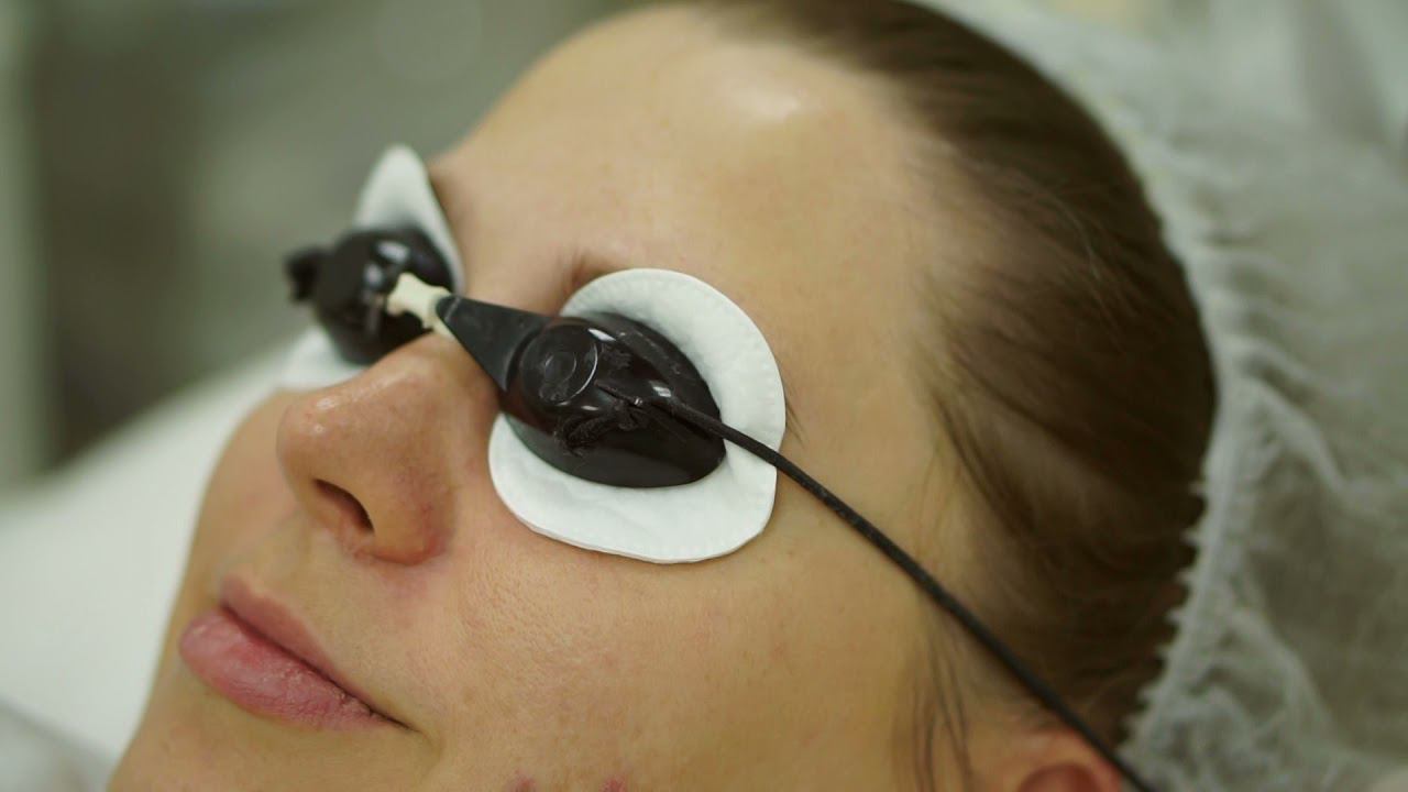 Фотодинамическая терапия (ФДТ). смотреть онлайн