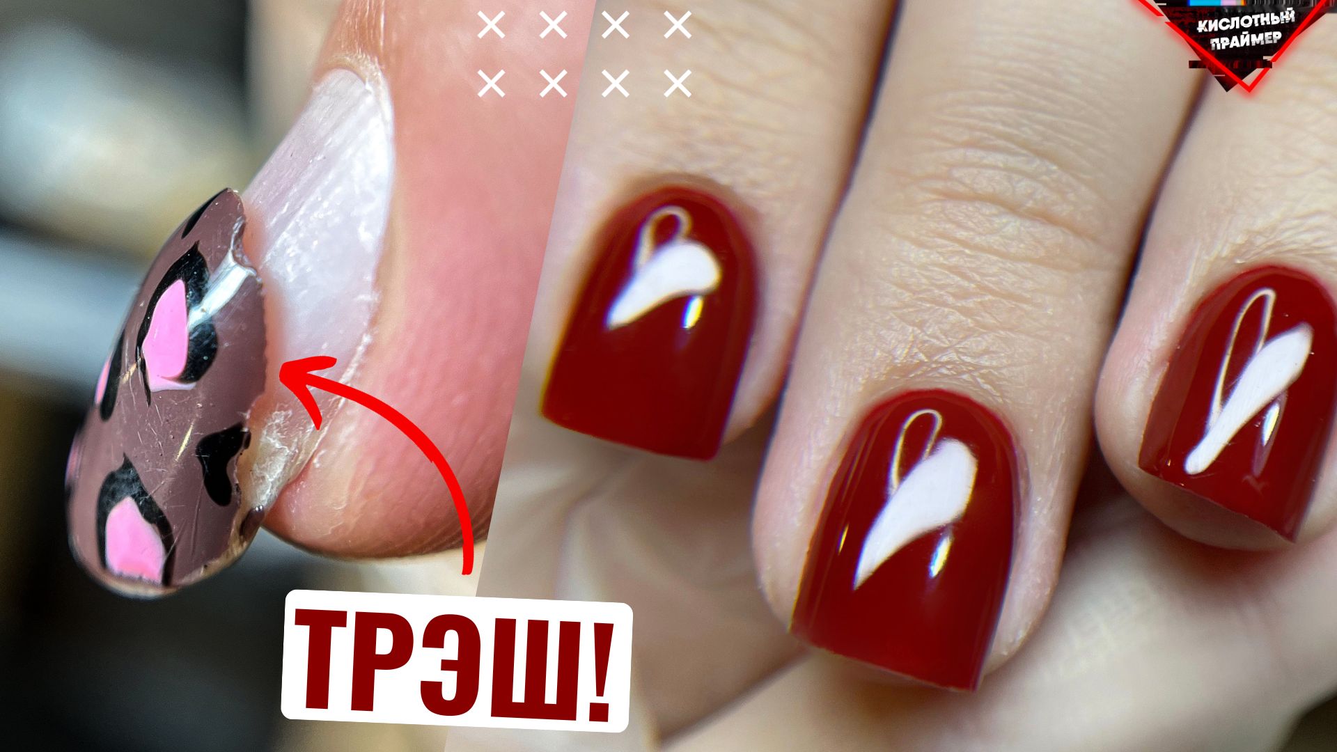 ЖЕСТКО ОТСЛОИЛСЯ НОГОТЬ! НАРАЩИВАНИЕ НОГТЕЙ ГЕЛЕМ! смотреть онлайн