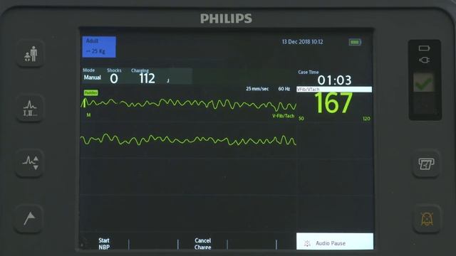 Manual Defibrillation with the HeartStart Intrepid monitor/defibrillator смотреть онлайн