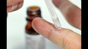 КАК ВЫВЕСТИ БОРОДАВКИ НА ПАЛЬЦАХ