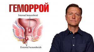 Лучшее натуральное средство от геморроя🔥