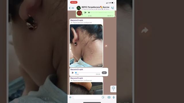 Контагиозный моллюск 👆 ELEV8 смотреть онлайн