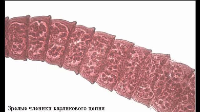 Гименолепидоз - Карликовый Цепень: Строение Морфология Жизненный Цикл Диагностика Профилактика смотреть онлайн