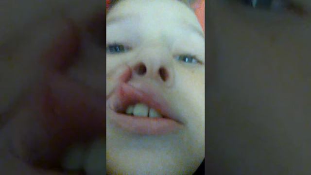 Короче говоря , разбила губу смотреть онлайн