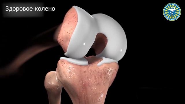 ТИЗЕ ООРУСУ КАНДАЙ БОЛОТ? Ортопед-травматолог Нурбек Рыскулов смотреть онлайн