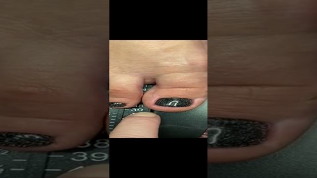 Консультация по обуви у подолога