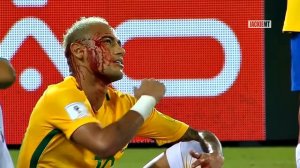 Травмы футболистов