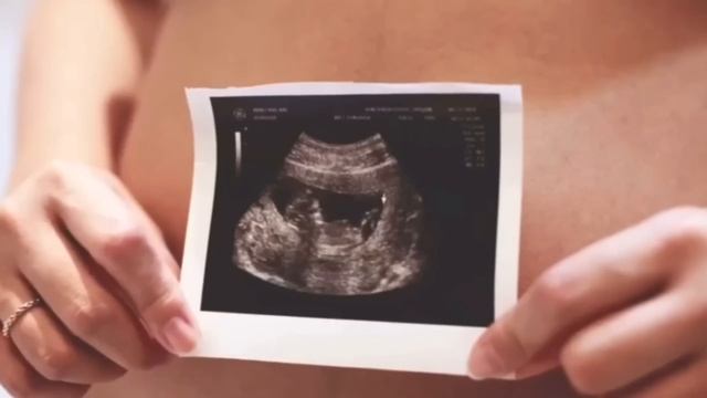 Многие едят ФИНИКИ и даже не знают вред фиников ! смотреть онлайн