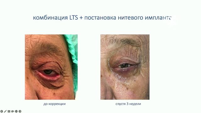 Секция «Нестандартные случаи и особенные пациенты» смотреть онлайн