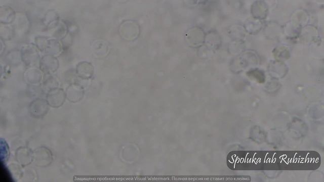 CDD.метиленовый синий. смотреть онлайн