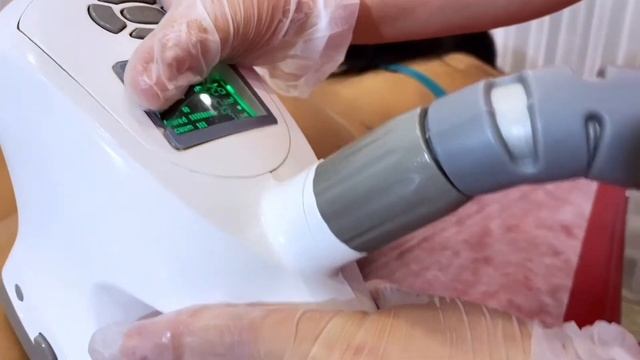 Велашейп (VeLA Shape) смотреть онлайн