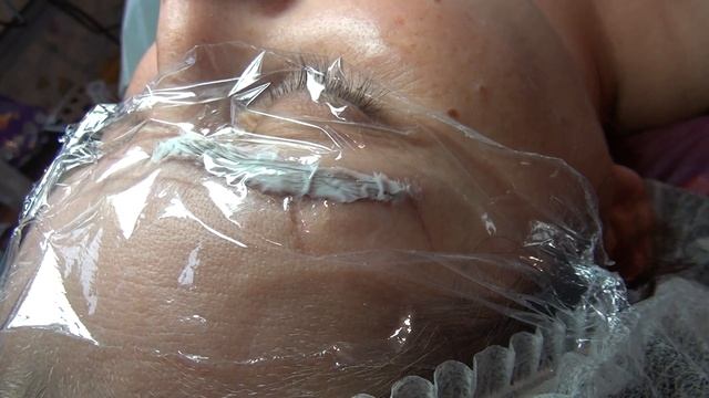 Анестезия брови перед микроблейдингом смотреть онлайн