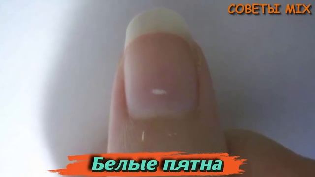 Взгляните на руки: Секреты, которые могут определить болезнь по состоянию ногтей смотреть онлайн